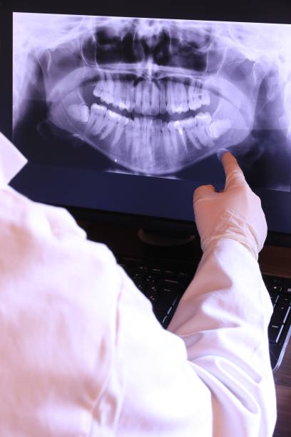 Best Broken or Cracked Tooth Emergency Dentist in West Hills, NY